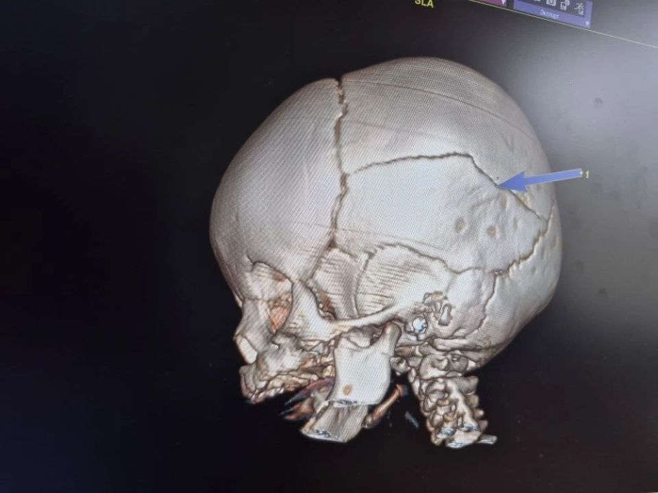 � ������� �� ����������� �������� ��������� �������� � ������� ���������