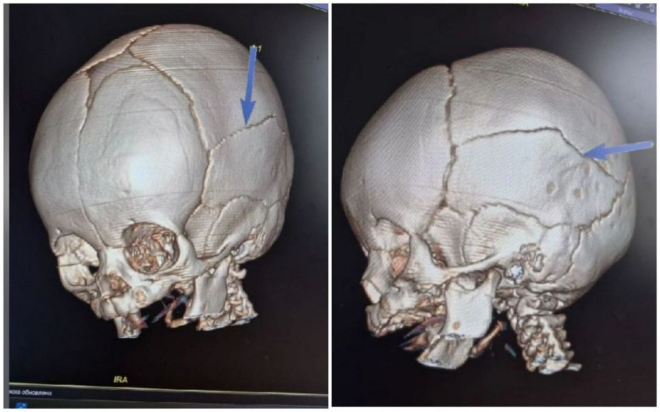 � �������� ����� ���� � ������� � ������ �����