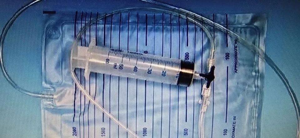 В Саратовской области юношу пронзил камыш В Саратовской области юношу пронзил камыш